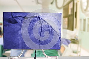 Cardiac Catheterization with Coronary Angiography on blurry Angiography Room Cardiac Catherization Lab Room