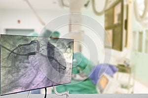 Cardiac Catheterization with Coronary Angiography on blurry Angiography Room Cardiac Catherization Lab Room photo