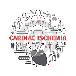 Cardiac ischemia banner. Symptoms, Treatment. Line icons set. Vector signs for web graphics.