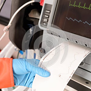 Cardiac monitor printing ekg results monitor pulse photo