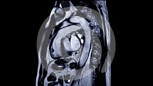 Cardiac MRI images are instrumental in assessing cardiac health, identifying heart abnormalities, and guiding treatment plans