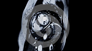 Cardiac MRI images are instrumental in assessing cardiac health, identifying heart abnormalities, and guiding treatment plans