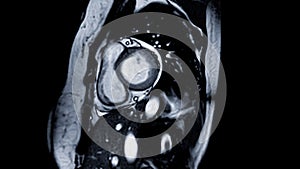 Cardiac MRI images are instrumental in assessing cardiac health, identifying heart abnormalities, and guiding treatment plans