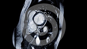 Cardiac MRI images are instrumental in assessing cardiac health, identifying heart abnormalities, and guiding treatment plans