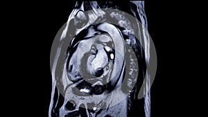 Cardiac MRI images are instrumental in assessing cardiac health, identifying heart abnormalities, and guiding treatment plans