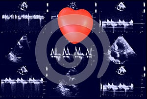 Cardiac ultrasound images and small heart . Doppler echo