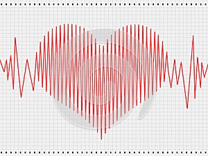 Cardiogram