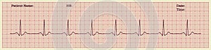 Cardiogram