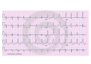 Cardiogram