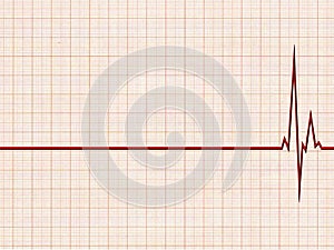 Cardiogram photo