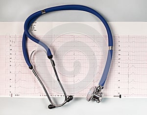 Cardiogram background through magnifying glass, cardiology. ECG and stethoscope