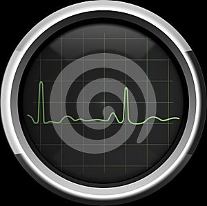 The cardiogram on the cardiomonitor screen in green tones