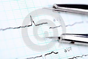CardiogramÃÂ and a compass