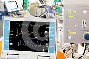 Cardiogram with ECMO