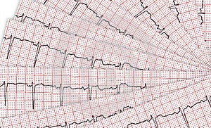 Cardiogram. A few research result by CU