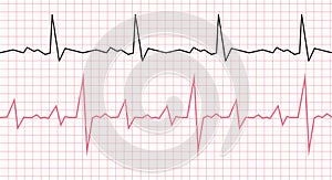 Cardiogram on a graph paper. Heartbeat line. Vector illustration