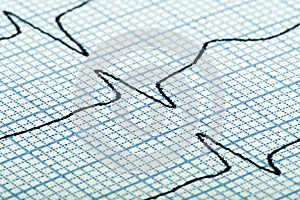 Cardiogram of heart beat