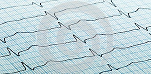 Cardiogram of heart beat