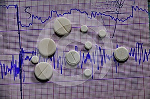 Cardiogram. Heart beat. Heartbeat line. Electrocardiogram