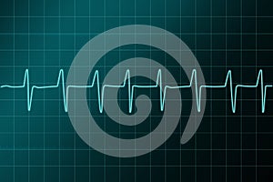 Cardiogram ritm illustration. photo