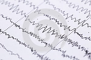 Cardiogram on a sheet of paper close-up. Texture of pulsed waves