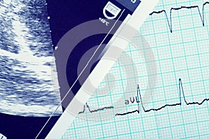 Cardiogram and ultrasound scan