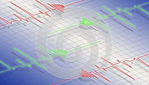 Cardiogram wave