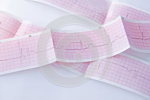 Cardiogram of young person. ECG diagram, medical examination. Heart disease,mitral valve prolapse click-murmur syndrome