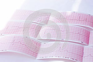 Cardiogram of young person. ECG diagram, medical examination. Heart disease,mitral valve prolapse click-murmur syndrome