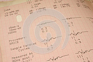Cardiological test results photo