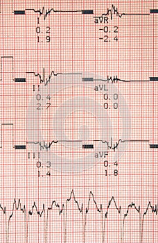 Cardiological tests results photo