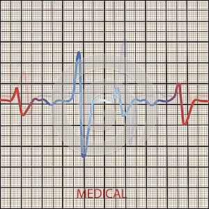 Cardiology concept with pulse rate diagram. Medical background with heart cardiogram.