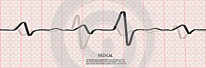 Cardiology concept with pulse rate diagram. Medical background with heart cardiogram