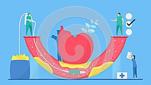 Cardiology vector illustration. Atherosclerosis is disease that plaque builds up inside arteries. Blood vessel is narrow and hard