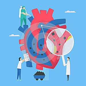 Cardiology vector illustration. This disease calls endocarditis. It is infection of endocardium that is inner heart chambers and