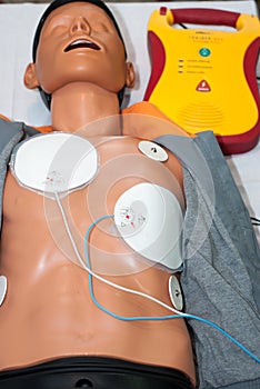 Cardiopulmonary resuscitation with AED