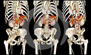 Cardiovascular system on computed tomography