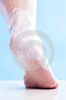 Care for dry skin on the well-groomed feet and heels with creams