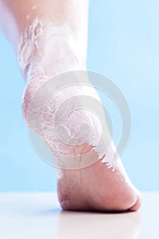 Care for dry skin on the well-groomed feet and heels with creams