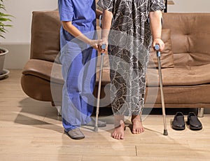 Caregiver takecare senior woman that leg is edema (swelling) . photo