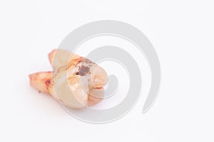 Caries on the teeth on the white background