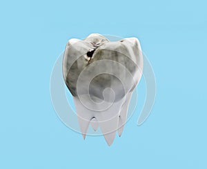 Carious molar tooth on blue background