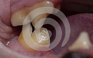 Carnassial teeth of a felid cat's top and lower jaw Fishing cat