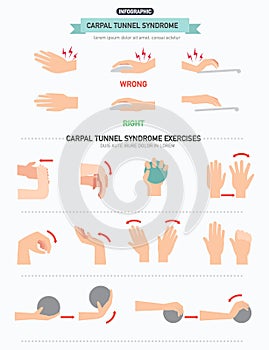 Carpal tunnel syndrome infographic