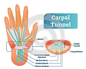 Carpal tunnel vector illustration scheme. Medical labeled diagram closeup with transverse carpal ligament and median nerve.