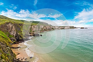 Carrick-a-Rede, Causeway Coast