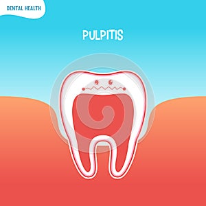 Cartoon bad tooth icon with pulpitis