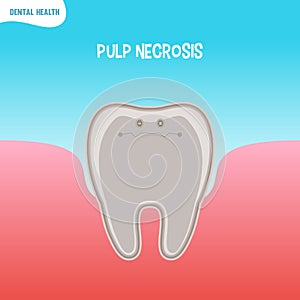 Cartoon bad tooth icon with pupl necrosis
