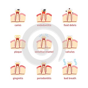 Cartoon Dental Problems Set . Vector photo