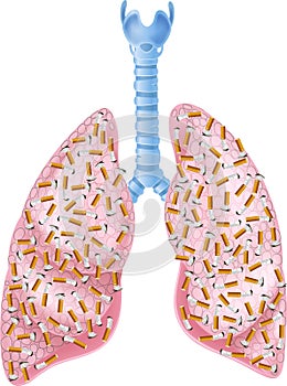 Cartoon illustration of Smokers Lungs